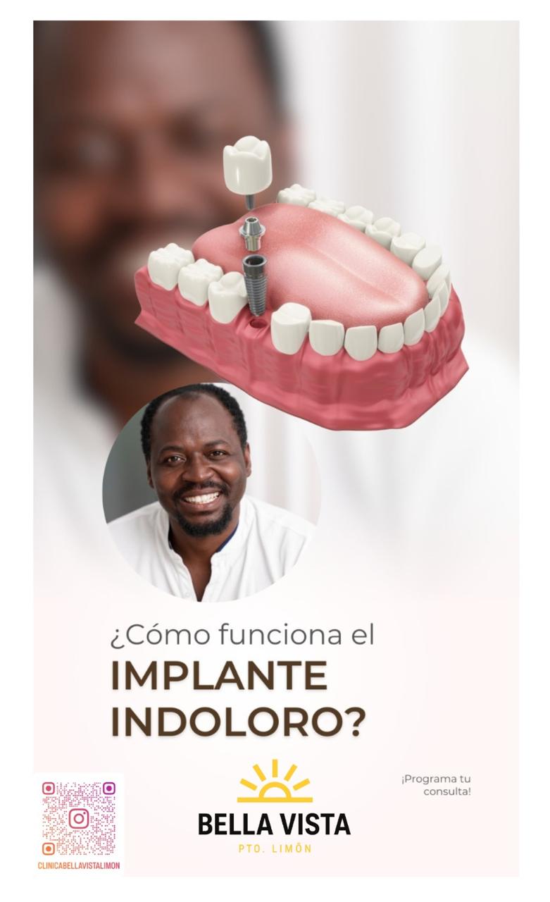 Información de Clínica Bella Vista sobre implantes dentales